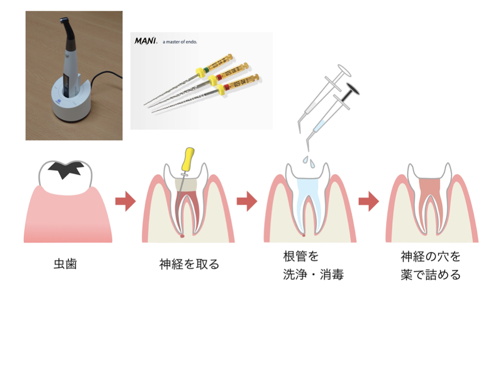 名称未設定.001